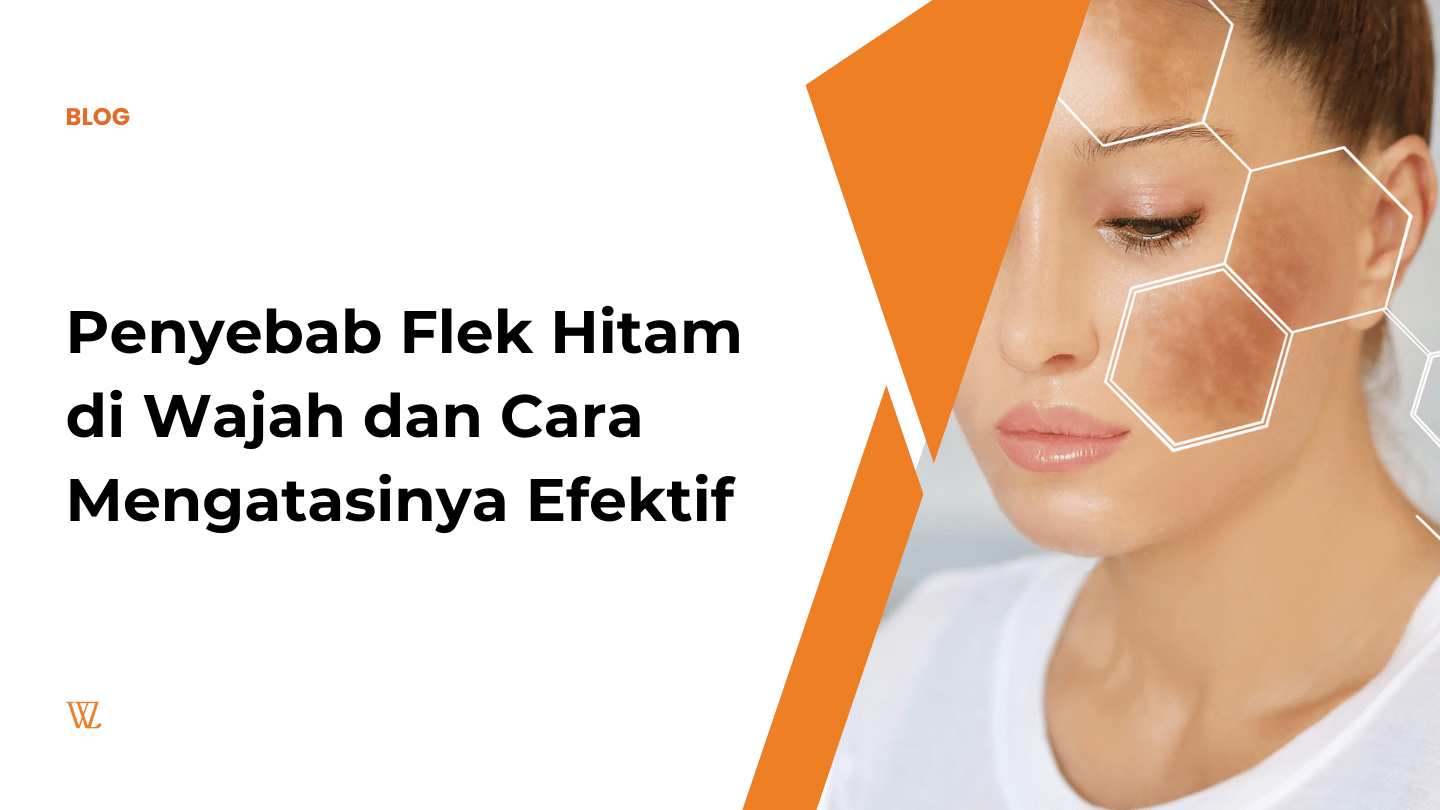 penyebab flek hitam di wajah